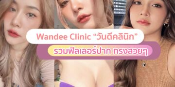 ฟิลเลอร์ปาก